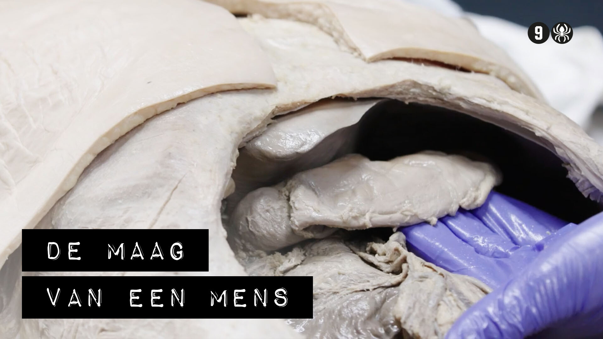 Schooltv: De Binnendienst - De maag van een mens