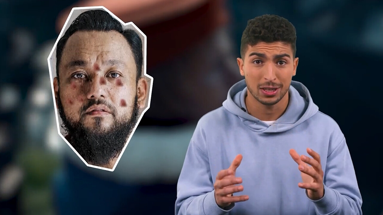 Schooltv: Histories - Wat voor ziekte was de pest?