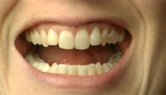 duurzame grondstof Geschikt Bederven Schooltv: Tanden en kiezen - De functie en bouw van tanden en kiezen