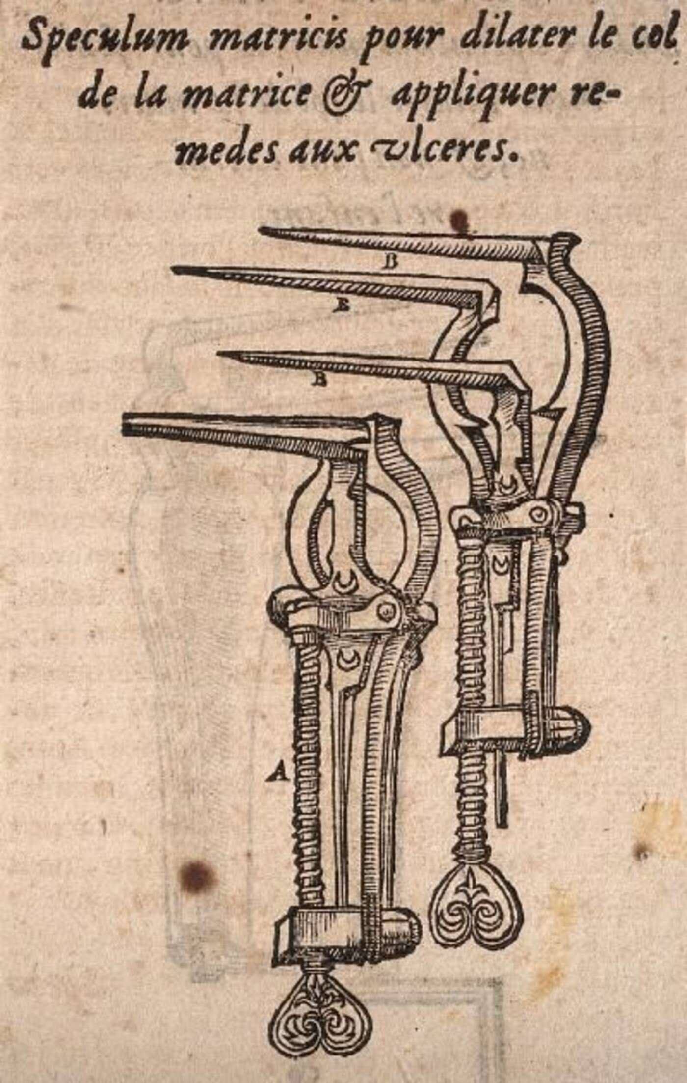 #1252 - Oorsprong van de gynaecologische eendenbek