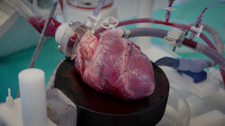 Kun je een hart repareren met geprint hartspierweefsel?: Een stukje hart uit de 3D-printer