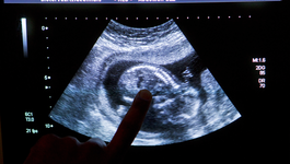 Door De Wereld - Leven Na Een Keuze Voor Abortus