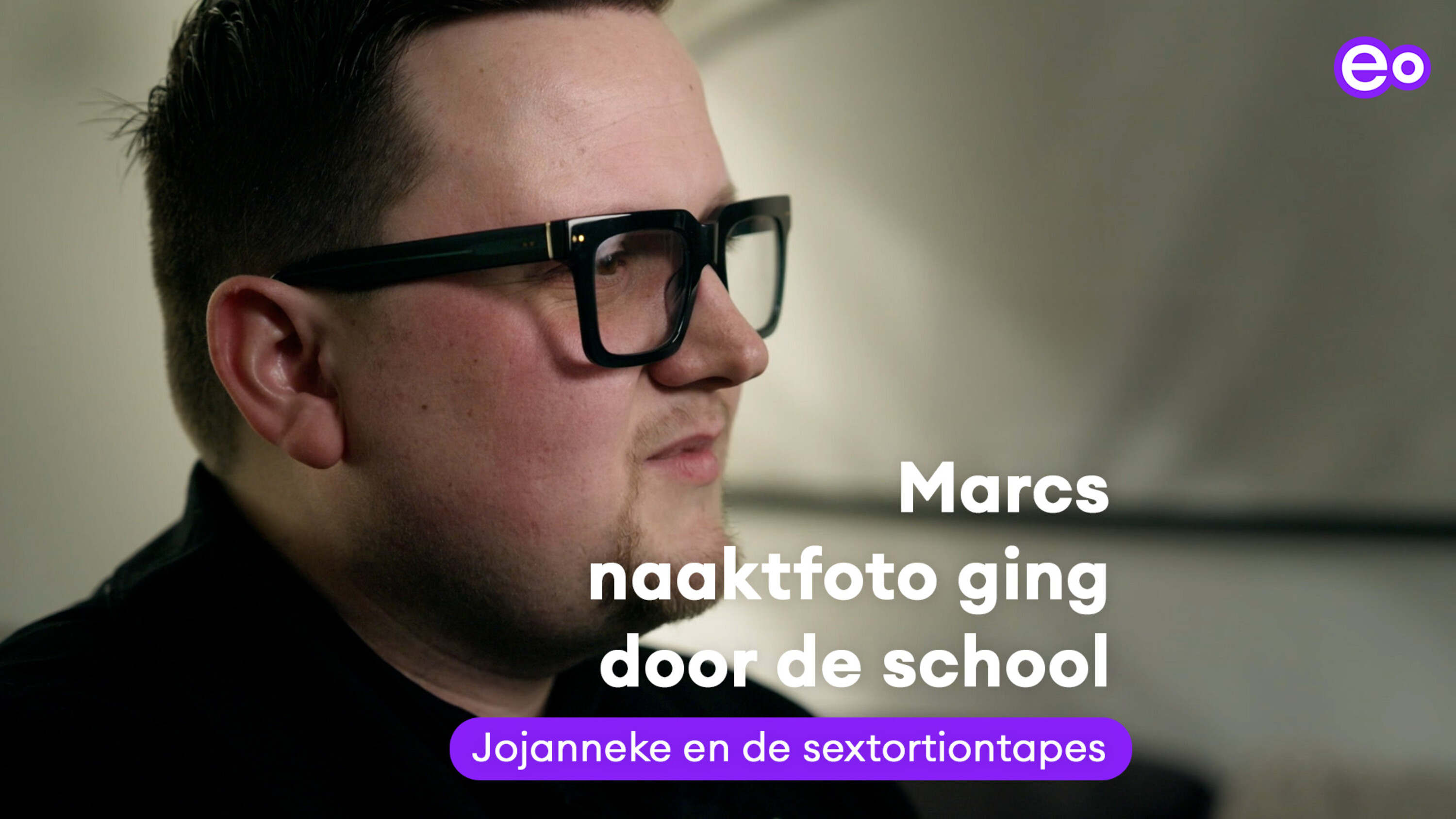 Hope tape Marc