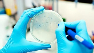 De Kennis van Nu Superefficiënte bacteriekiller