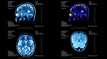 Wat is neuromarketing?: Reclame die je onderbewuste beïnvloedt