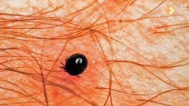 Nieuws uit de natuur: Teken en de ziekte van Lyme
