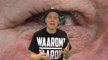Waarom hebben mensen soms wallen onder hun ogen?