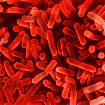 legionella legionella