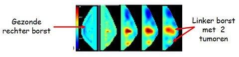 infraroodscan