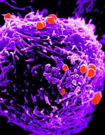 Noorderlicht antibioticaresistentie