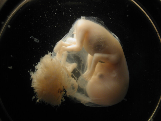 embryo embryo