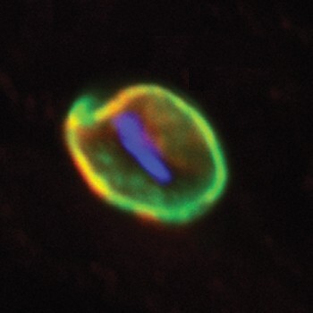 Noorderlicht: nieuws malaria Noorderlicht: nieuws malaria